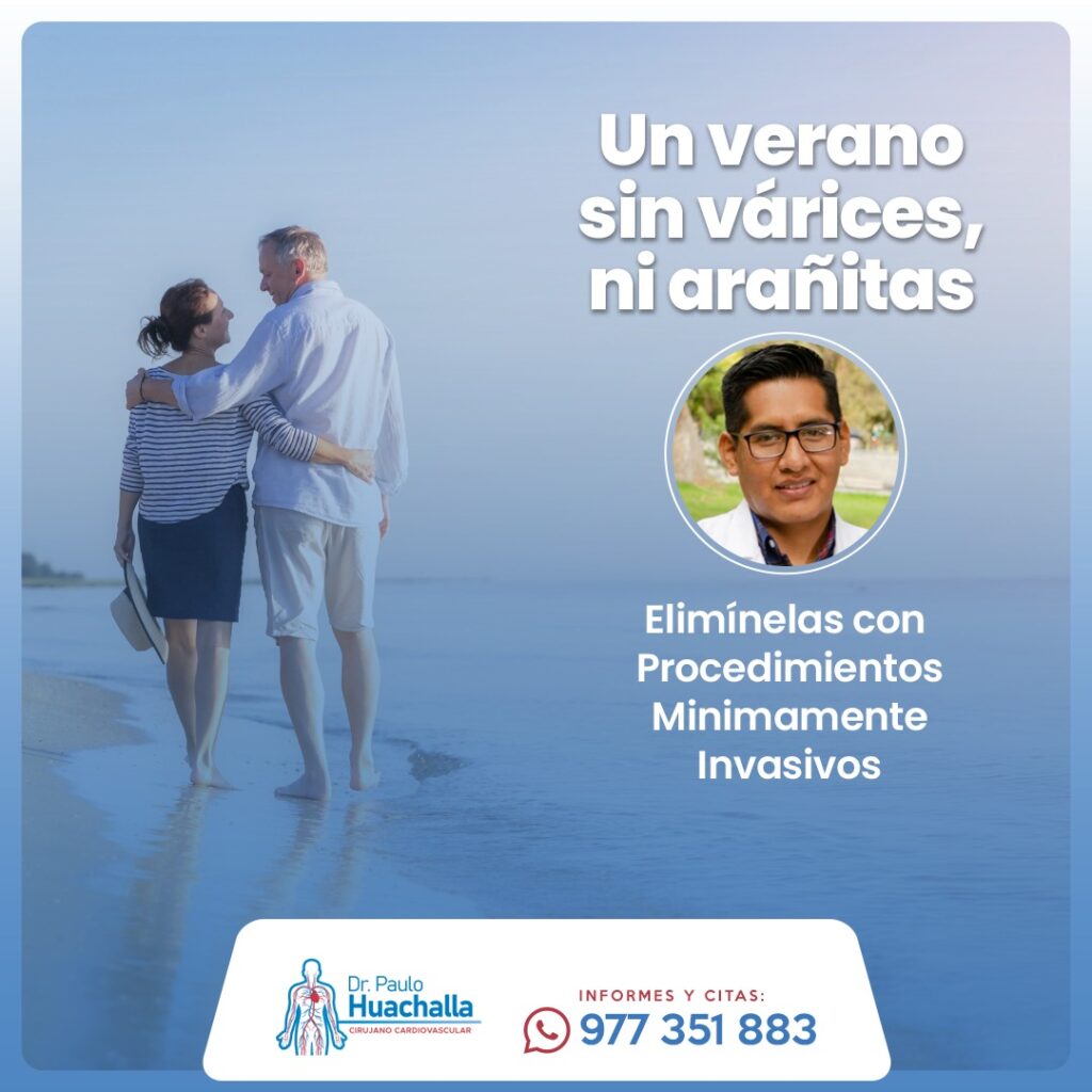 Un verano sin dolor en sus piernas con várices
