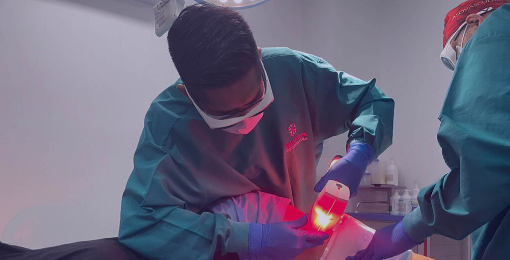 How Much Does Varicose Vein Surgery Cost in Lima – A Surgeon’s Opinion