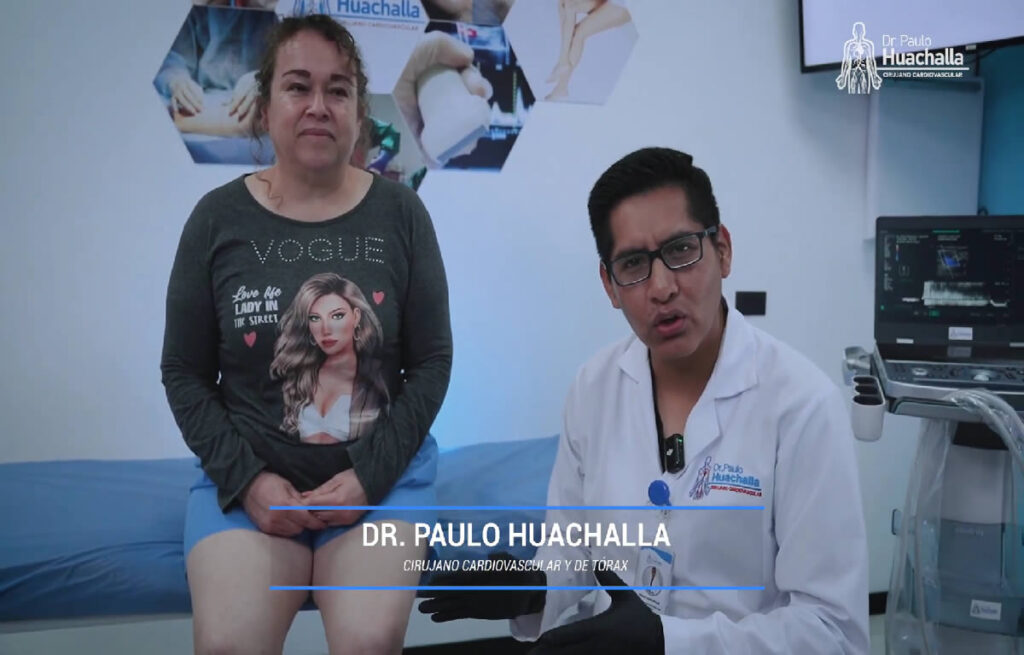 ¿Qué especialidad ve las várices? El Cirujano Cardiovascular