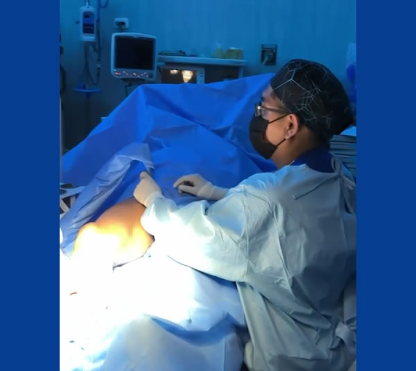 Ablación endovascular con láser de última generación