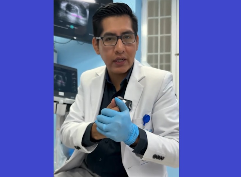 Paciente con Tromboflebitis por no Tratar las Várices