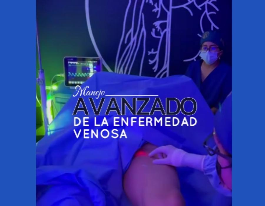 Conoce nuestro manejo avanzado de la enfermedad venosa