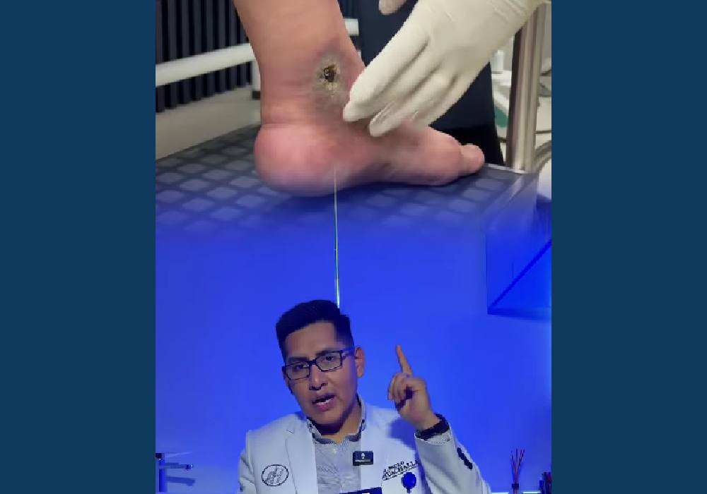 Do you have a wound that won’t heal? It could be a venous problem